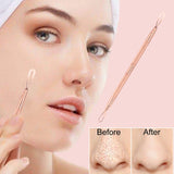 1 Professional Stainless Steel Blackhead Remover Blemish Extractor Tool – Acne Skin Nose Face Tzone Whitehead Zit Pimple Popper Comedone Pustule Removal Double Ended 2 in 1 Nonslip